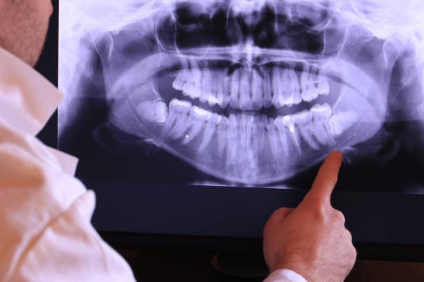 Best Broken or Cracked Tooth Emergency Dentist in Buna, TX